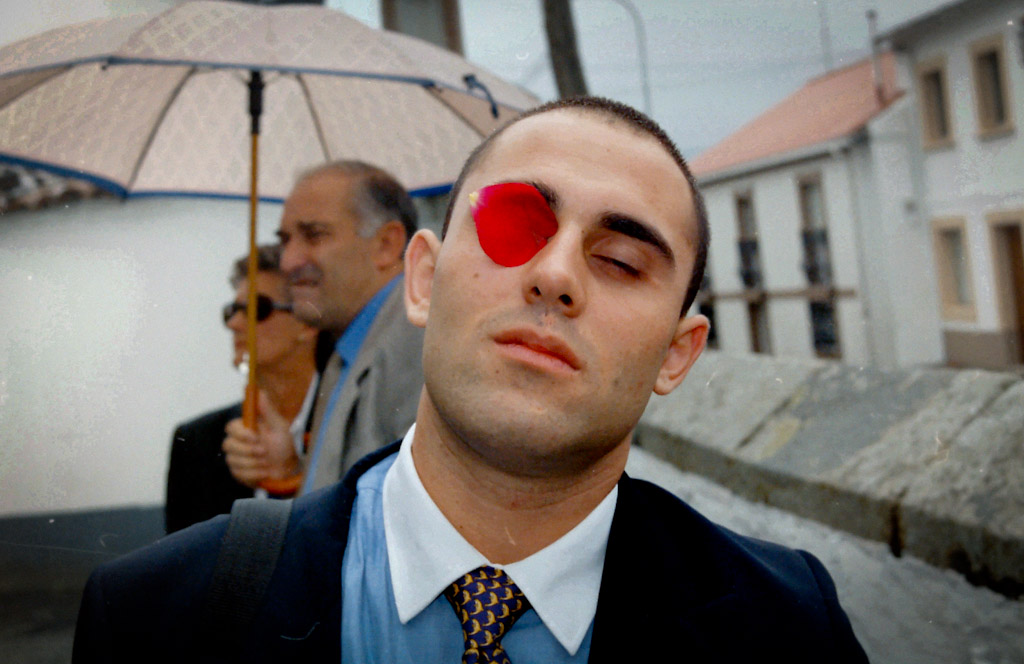 Con parche en el ojo